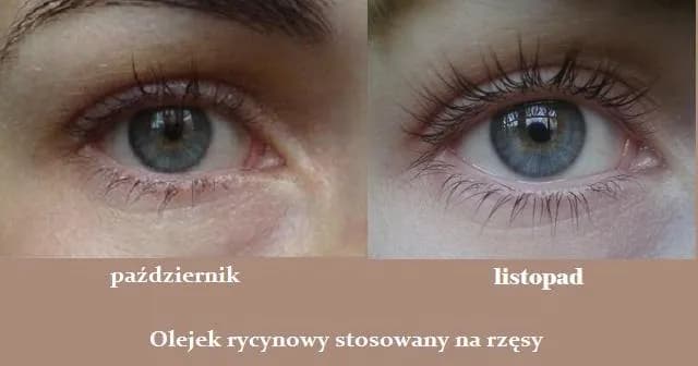 Jak używać olejku rycynowego na rzęsy, by uniknąć podrażnień i uzyskać efekty Jak używać olejku rycynowego na rzęsy, by uniknąć podrażnień i uzyskać efekty