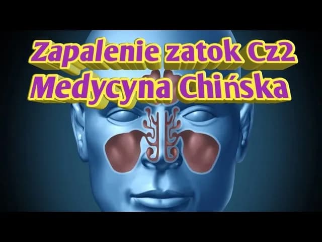 Medycyna chińska zatoki: Jak skutecznie leczyć zapalenie zatok? Medycyna chińska zatoki: Jak skutecznie leczyć zapalenie zatok?