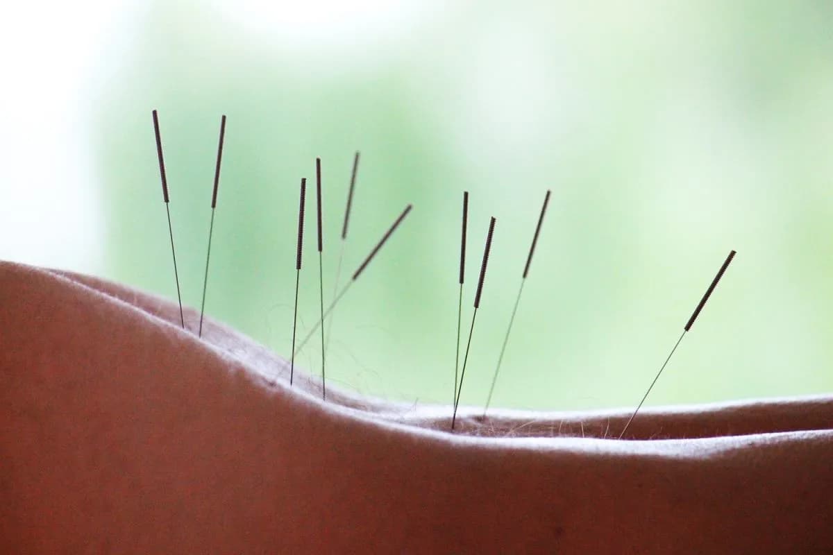 Najlepsze książki o akupunkturze, które zmienią twoją praktykę Najlepsze książki o akupunkturze, które zmienią twoją praktykę
